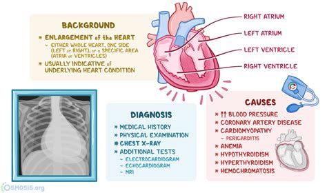 Enlarged Heart (Cardiomegaly): What It Is, Symptoms & Treatment.